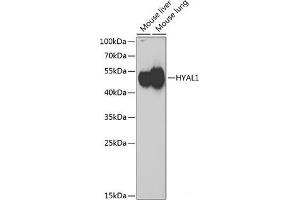 Western blot analysis of extracts of various cell lines using HYAL1 Polyclonal Antibody at dilution of 1:1000. (HYAL1 antibody)