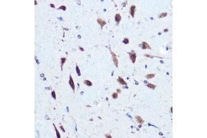 Immunohistochemistry of paraffin-embedded rat brain using hnRNP E2/PCBP2 Rabbit pAb (ABIN3023339, ABIN3023340, ABIN3023341 and ABIN6219620) at dilution of 1:100 (40x lens). (PCBP2 antibody  (AA 1-130))