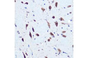 Immunohistochemistry of paraffin-embedded rat brain using hnRNP E2/PCBP2 Rabbit pAb (ABIN3023339, ABIN3023340, ABIN3023341 and ABIN6219620) at dilution of 1:100 (40x lens). (PCBP2 antibody  (AA 1-130))