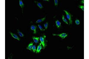 Immunofluorescent analysis of Hela cells using ABIN7169956 at dilution of 1:100 and Alexa Fluor 488-congugated AffiniPure Goat Anti-Rabbit IgG(H+L) (TAUT antibody  (AA 1-49))