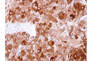 IHC-P Image LTBP4 antibody [N1N2], N-term detects LTBP4 protein at cytosol on human adrenal gland tumor by immunohistochemical analysis.