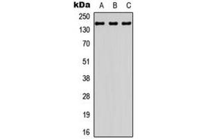 Western blot analysis of BCR expression in HepG2 (A), mouse brain (B), rat brain (C) whole cell lysates. (BCR antibody  (N-Term))