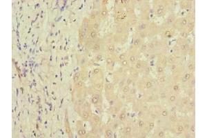 Immunohistochemistry of paraffin-embedded human liver tissue using ABIN7164073 at dilution of 1:100 (PQLC3 antibody  (AA 118-170))