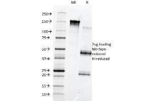 SDS-PAGE Analysis Purified Fibronectin Monoclonal Antibody (568). (Fibronectin 1 antibody)