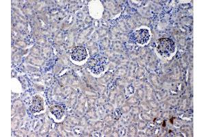 IHC analysis of Crp using anti- Crp antibody . (CRP antibody  (AA 20-225))