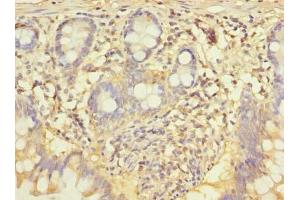 Immunohistochemistry of paraffin-embedded human small intestine tissue using ABIN7148943 at dilution of 1:100 (CCNJL antibody  (AA 315-435))
