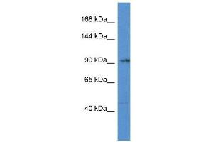 Western Blot showing Tnni3k antibody used at a concentration of 1. (TNNI3K antibody  (Middle Region))