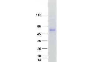 Validation with Western Blot