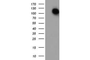 HEK293T cells were transfected with the pCMV6-ENTRY control (Left lane) or pCMV6-ENTRY ENPEP (Right lane) cDNA for 48 hrs and lysed. (ENPEP antibody)