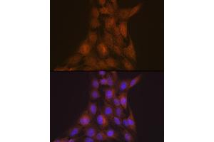 Immunofluorescence (IF) image for anti-Platelet-Activating Factor Acetylhydrolase 1b, Regulatory Subunit 1 (45kDa) (PAFAH1B1) antibody (ABIN7269401)