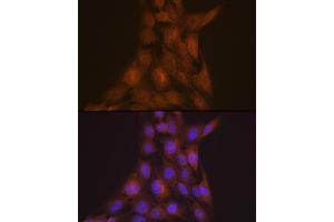 Immunofluorescence analysis of C6 cells using LIS1 Rabbit mAb (ABIN7269401) at dilution of 1:100 (40x lens). (PAFAH1B1 antibody)