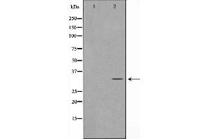 Western blot analysis on Jurkat cell lysate using MAST4 Antibody，The lane on the left is treated with the antigen-specific peptide. (MAST4 antibody  (N-Term))