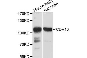 Western blot analysis of extract of mouse brain and rat brain cells, using CDH10 antibody.