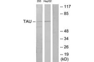 Western blot analysis of extracts from 293/HepG2 cells, using Tau (Ab-181) Antibody. (tau antibody  (AA 471-520))