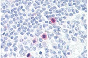 Anti-PLA2G4A antibody IHC staining of human tonsil, mitotic figures. (PLA2G4A antibody  (AA 471-520))