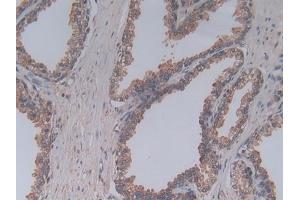 Immunohistochemistry (IHC) image for anti-Complement Component 5a (C5a) (AA 678-751) antibody (ABIN7442321)