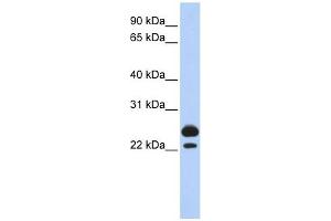 AK1 antibody used at 1 ug/ml to detect target protein. (Adenylate Kinase 1 antibody  (Middle Region))
