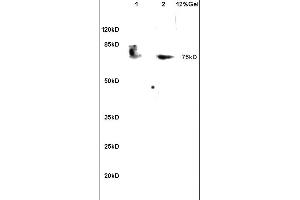 Lane 1: mouse heart lysates Lane 2: mouse kidney lysates probed with Anti PABP (Methyl Arg455/460) Polyclonal Antibody, Unconjugated (ABIN704831) at 1:200 in 4C. (PABP antibody  (meArg455, meArg460))