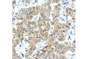 IHC analysis of ONECUT1 using anti-ONECUT1 antibody (ABIN7599190). (ONECUT1 antibody  (AA 1-270))