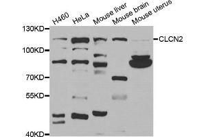 Western Blotting (WB) image for anti-Chloride Channel 2 (CLCN2) antibody (ABIN1877106) (CLCN2 antibody)