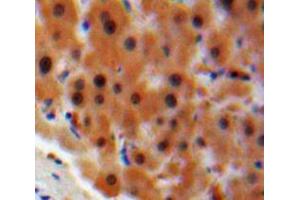 IHC-P analysis of Liver tissue, with DAB staining. (STAT2 antibody  (AA 616-849))