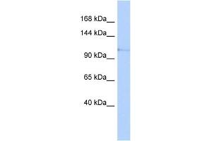 WB Suggested Anti-TLR5 Antibody Titration: 0. (TLR5 antibody  (N-Term))