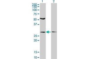 Western Blot analysis of IFT57 expression in transfected 293T cell line by IFT57 monoclonal antibody (M04), clone 3G4. (IFT57 antibody  (AA 214-312))