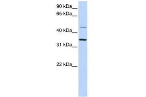 CLN6 antibody used at 1 ug/ml to detect target protein.