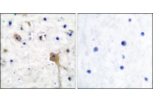 Immunohistochemical analysis of paraffin-embedded human brain tissue using SH-PTP2 antibody. (PTPN11 antibody)