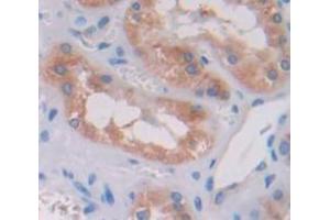 Used in DAB staining on fromalin fixed paraffin- embedded Kidney tissue (TRIP6 antibody  (AA 279-476))