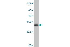 Western Blotting (WB) image for anti-Actinin, alpha 4 (ACTN4) (AA 592-701) antibody (ABIN559759)