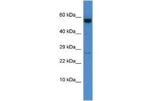Host: Rabbit Target Name: CASP10 Sample Type: HCT15 Whole Cell lysates Antibody Dilution: 1. (Caspase 10 antibody  (C-Term))