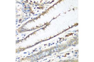 Immunohistochemistry of paraffin-embedded human stomach using CAD antibody (ABIN5974557) at dilution of 1/100 (40x lens).