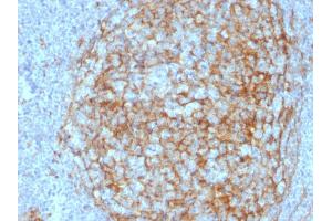 Formalin-fixed, paraffin-embedded human Lymph Node stained with CD14 Mouse Monoclonal Antibody (LPSR/2408).