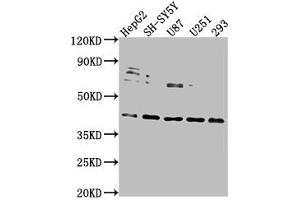 Western Blot Positive WB detected in: HepG2 whole cell lysate, SH-SY5Y whole cell lysate, U87 whole cell lysate, U251 whole cell lysate, 293 whole cell lysate All lanes: LRTM2 antibody at 1:2000 Secondary Goat polyclonal to rabbit IgG at 1/50000 dilution Predicted band size: 42 kDa Observed band size: 42 kDa (LRTM2 antibody  (AA 36-310))
