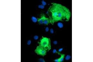 Anti-SCHIP1 mouse monoclonal antibody (ABIN2455645) immunofluorescent staining of COS7 cells transiently transfected by pCMV6-ENTRY SCHIP1 (RC206269). (SCHIP1 antibody)