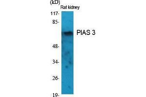 Western Blot (WB) analysis of specific cells using PIAS 3 Polyclonal Antibody. (PIAS3 antibody  (N-Term))