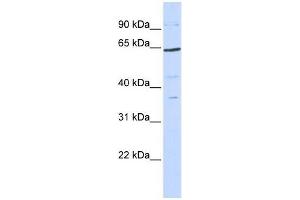 Human 293T; WB Suggested Anti-TCF7L1 Antibody Titration: 0. (TCF7L1 antibody  (N-Term))