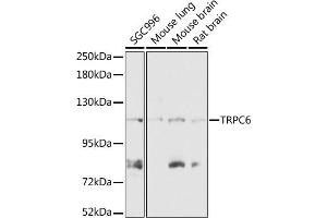 Western blot analysis of extracts of various cell lines, using TRPC6 antibody (ABIN7270918) at 1:1000 dilution. (TRPC6 antibody  (AA 732-931))