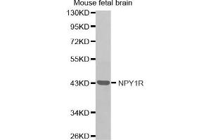 Western Blotting (WB) image for anti-Neuropeptide Y Receptor Y1 (NPY1R) antibody (ABIN3017402) (NPY1R antibody)