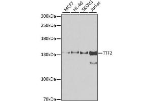 Western blot analysis of extracts of various cell lines, using TTF2 antibody. (TTF2 antibody)
