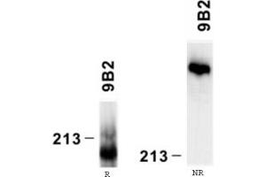 Reactivity of laminin alpha4 chain specific monoclonal antibody 9B8 on human platelet lysate by Western blotting (reducing, R and nonreducing, NR conditions).