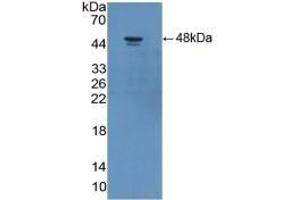 Detection of Recombinant ADIPOR2, Human using Polyclonal Antibody to Adiponectin Receptor 2 (ADIPOR2) (Adiponectin Receptor 2 antibody  (AA 2-155))