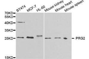 Western blot analysis of extracts of various cell lines, using PRG2 antibody. (PRG2 antibody  (AA 17-222))