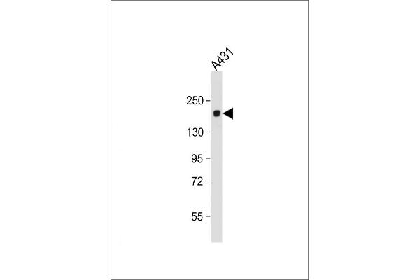 PRDM10 Antikörper  (N-Term)