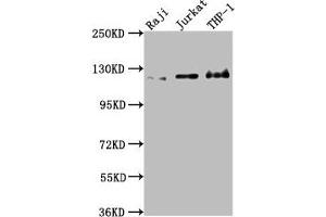 Western Blot Positive WB detected in: Raji whole cell lysate, Jurkat whole cell lysate, THP-1 whole cell lysate All lanes: MICAL1 antibody at 1:2000 Secondary Goat polyclonal to rabbit IgG at 1/50000 dilution Predicted band size: 118, 109, 38, 120 kDa Observed band size: 120 kDa (MICAL1 antibody  (AA 806-1067))