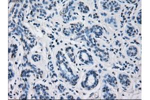 Immunohistochemical staining of paraffin-embedded breast tissue using anti-CYP2E1 mouse monoclonal antibody. (CYP2E1 antibody)