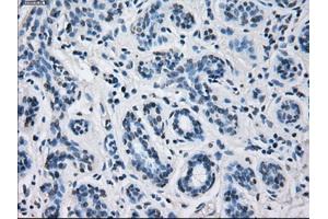 Immunohistochemical staining of paraffin-embedded breast tissue using anti-CYP2E1 mouse monoclonal antibody.