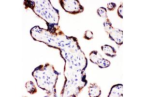 Anti-CYP11A1 antibody, IHC(P) IHC(P): Human Placenta Tissue