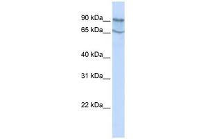MAP4K2 antibody used at 1 ug/ml to detect target protein. (MAP4K2 antibody  (N-Term))